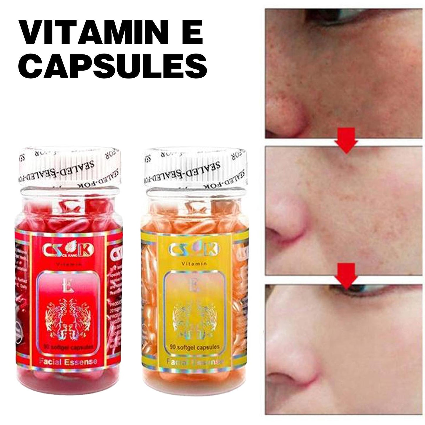 Vitamin E Capsules Spot Acne Removal