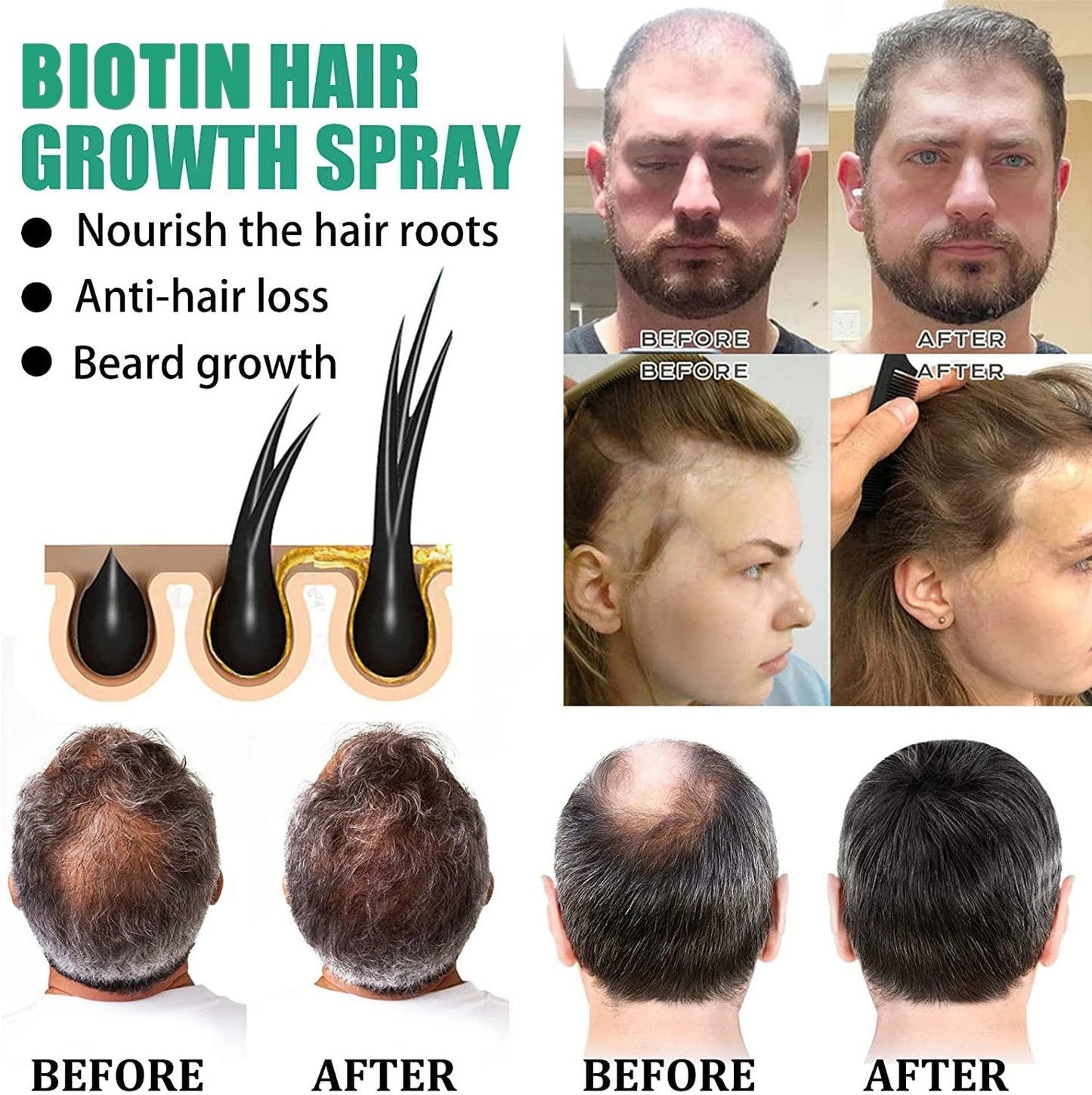 Biotin Fast Hair Growth Spray